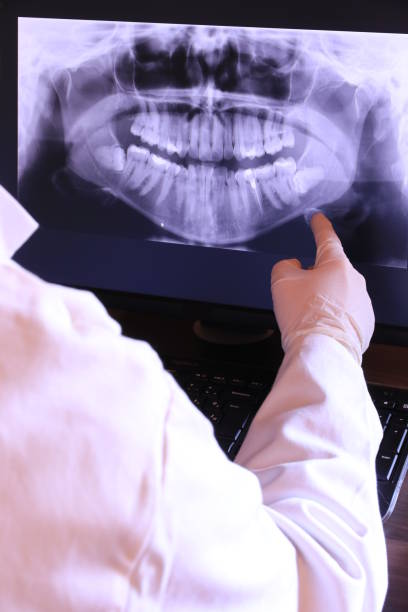 Best Walk-In Emergency Dental Services in Palatine, IL